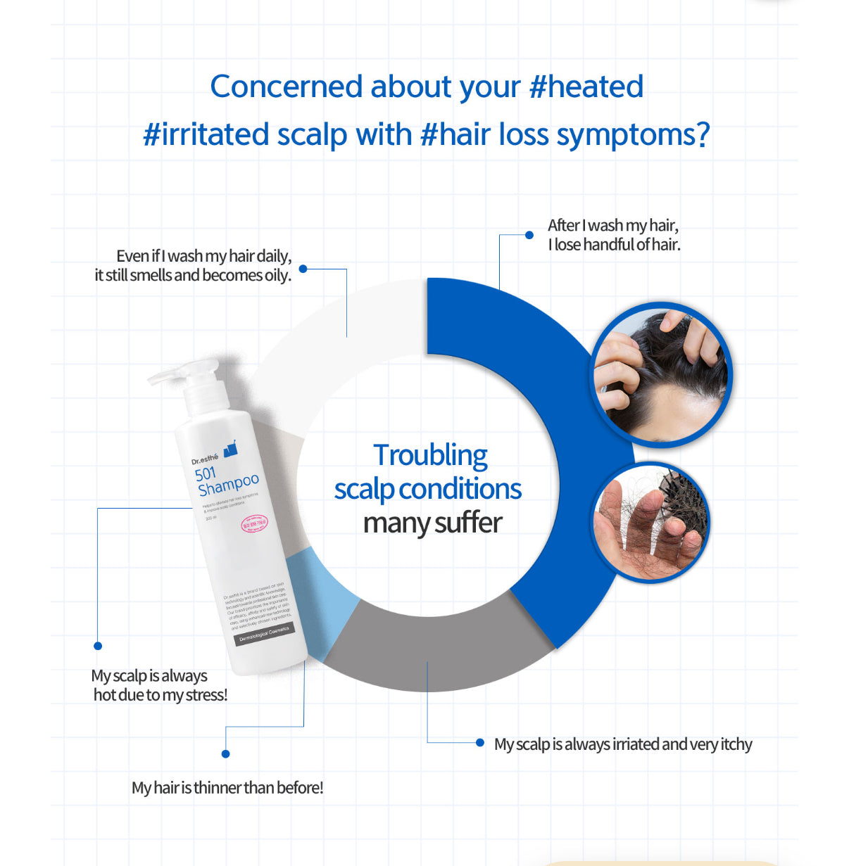 501 Shampoo- Hair Loss