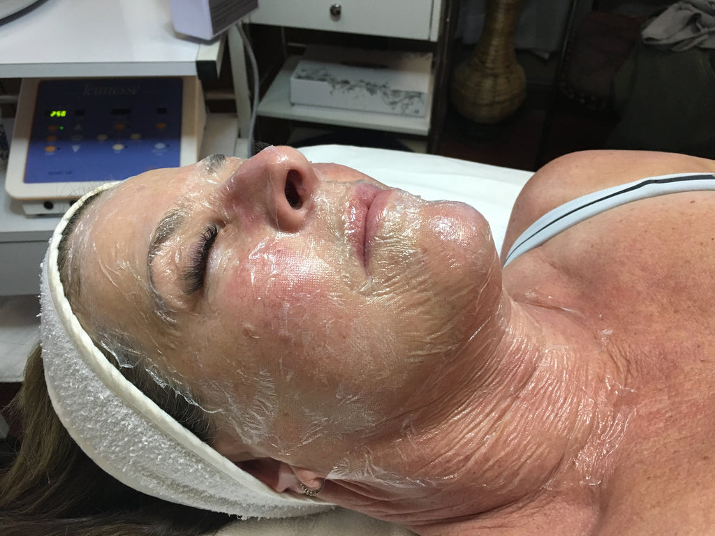 Sculplla Korean filler treatment